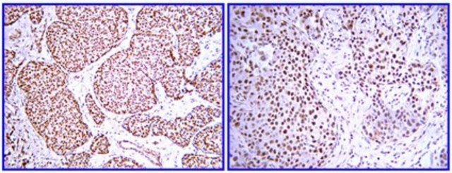 Anti-PDGF-BB Antibody from rabbit, purified by affinity chromatography