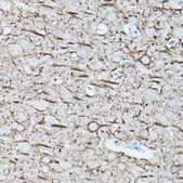 Anti-Neurofilament L Antibody, clone 3L9Y10, Rabbit Monoclonal