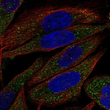 Anti-Ulbp2 Antibody Produced In Rabbit Prestige Antibodies&#174; Powered by Atlas Antibodies, affinity isolated antibody, buffered aqueous glycerol solution