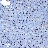 Anti-NAT10 antibody produced in rabbit