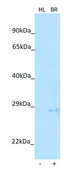 Anti-VSIG4 (N-terminal) antibody produced in rabbit affinity isolated antibody