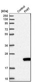Anti-FHIT antibody produced in rabbit Prestige Antibodies® Powered by Atlas Antibodies, affinity isolated antibody, buffered aqueous glycerol solution