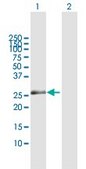 Anti-ZNF266 antibody produced in mouse purified immunoglobulin, buffered aqueous solution