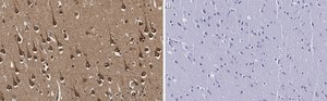 Anti-eIF-4E Antibody, clone 1K7 ZooMAb® Rabbit Monoclonal recombinant, expressed in HEK 293 cells