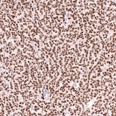 Anti-FOXL2 antibody produced in mouse Prestige Antibodies® Powered by Atlas Antibodies, clone CL12753, purified by using Protein A, buffered aqueous glycerol solution
