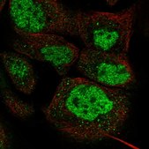 Anti-DPF2 antibody produced in rabbit affinity isolated antibody, buffered aqueous glycerol solution