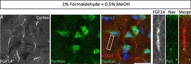 Anti-Sodium Channel, Pan antibody produced in rabbit affinity isolated antibody, lyophilized powder