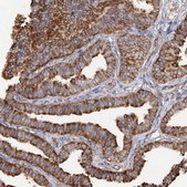 Anti-RPS25 antibody produced in rabbit Prestige Antibodies® Powered by Atlas Antibodies, affinity isolated antibody, buffered aqueous glycerol solution