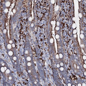 Anti-OSBPL2 antibody produced in rabbit Prestige Antibodies&#174; Powered by Atlas Antibodies, affinity isolated antibody, buffered aqueous glycerol solution