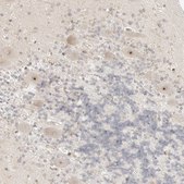 Anti-RPS6KL1 antibody produced in rabbit Prestige Antibodies® Powered by Atlas Antibodies, affinity isolated antibody, buffered aqueous glycerol solution