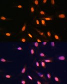 Anti-MonoMethyl-Histone H3-K4 antibody produced in rabbit