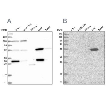 Anti-UGP2 antibody produced in rabbit Prestige Antibodies&#174; Powered by Atlas Antibodies, affinity isolated antibody, buffered aqueous glycerol solution