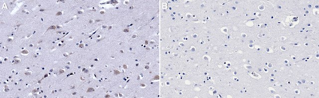 Anti-eIF2&#945; 兔抗 IgG fraction of antiserum, buffered aqueous solution