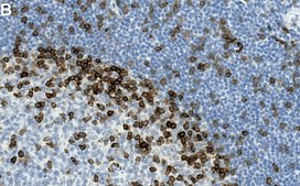 Anti-LAT Antibody, clone 2B4 ZooMAb® Rabbit Monoclonal recombinant, expressed in HEK 293 cells