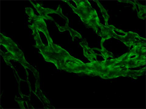 Monoclonal Anti-Nebulin antibody produced in mouse clone NB2, ascites fluid