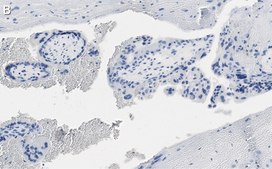 Anti-DAP Kinase 1 Antibody, clone 1J22 ZooMAb® Rabbit Monoclonal recombinant, expressed in HEK 293 cells