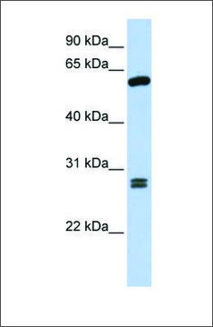 Anti-ACD antibody produced in rabbit affinity isolated antibody