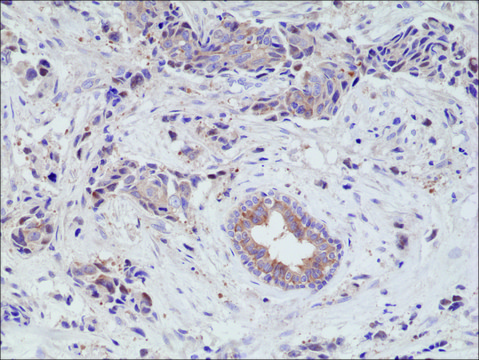 Anti-EGF Receptor antibody, Rabbit Monoclonal recombinant, expressed in HEK 293 cells, clone RM294, purified immunoglobulin