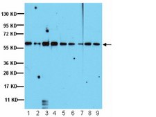 Anti-PP5 Antibody Upstate®, from rabbit