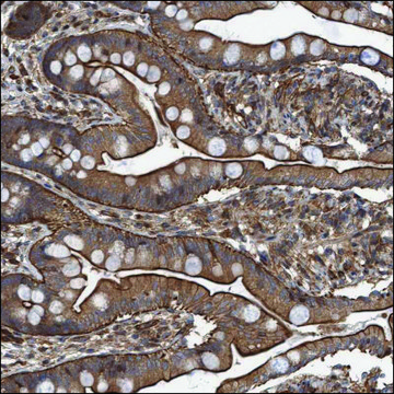 Anti-ROR2 antibody produced in rabbit Prestige Antibodies&#174; Powered by Atlas Antibodies, affinity isolated antibody, buffered aqueous glycerol solution