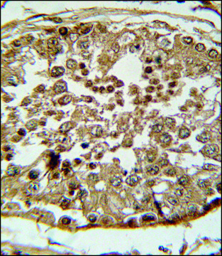 ANTI-SPAG1 (N-TERM) antibody produced in rabbit IgG fraction of antiserum, buffered aqueous solution