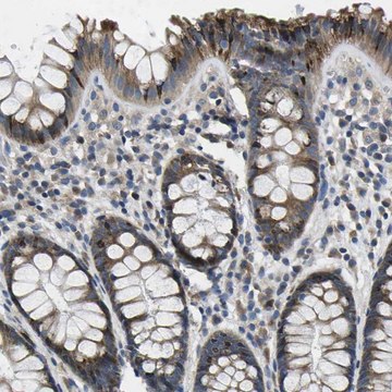 Anti-ERGIC3 antibody produced in rabbit Prestige Antibodies&#174; Powered by Atlas Antibodies, affinity isolated antibody, buffered aqueous glycerol solution