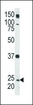 ANTI-RAB5(C-TERMINAL) antibody produced in rabbit affinity isolated antibody, buffered aqueous solution