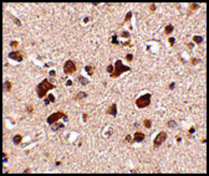 Anti-Slitrk6 (ab1) antibody produced in rabbit affinity isolated antibody, buffered aqueous solution