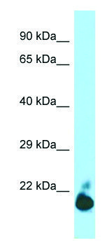 Anti-TIGIT (C-terminal) antibody produced in rabbit affinity isolated antibody