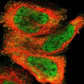 Anti-ZDHHC8 antibody produced in rabbit Prestige Antibodies® Powered by Atlas Antibodies, affinity isolated antibody, buffered aqueous glycerol solution
