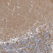 Anti-MPP3 antibody produced in rabbit Prestige Antibodies® Powered by Atlas Antibodies, affinity isolated antibody, buffered aqueous glycerol solution, Ab2
