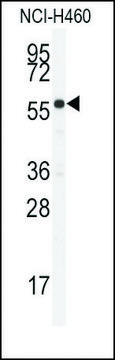 Anti-CYP21A2 (N-term) antibody produced in rabbit saturated ammonium sulfate (SAS) precipitated, buffered aqueous solution