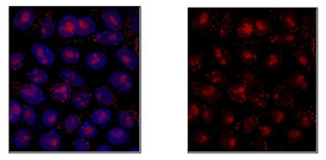 Anti-Tet2 Antibody from rabbit, purified by affinity chromatography