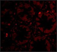 Anti-PTK7 antibody produced in rabbit affinity isolated antibody, buffered aqueous solution