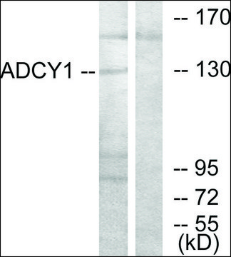 Anti-ADCY1 antibody produced in rabbit affinity isolated antibody