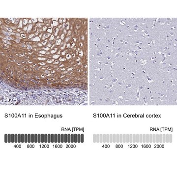 Anti-S100A11 antibody produced in rabbit Prestige Antibodies&#174; Powered by Atlas Antibodies, affinity isolated antibody, buffered aqueous glycerol solution