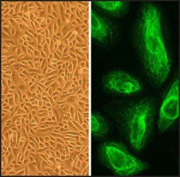 Human Placental Epithelial Cells: HPlEpC, fetal