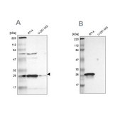 Anti-HPGD antibody produced in rabbit Ab1, Prestige Antibodies® Powered by Atlas Antibodies, affinity isolated antibody, buffered aqueous glycerol solution