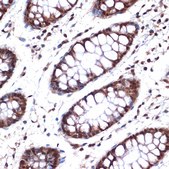 Anti-NUP153 antibody produced in rabbit