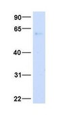 Anti-LGALS3 antibody produced in rabbit affinity isolated antibody