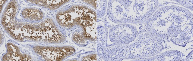 Anti-LZTFL1 Antibody, clone 1I2 ZooMAb&#174; Rabbit Monoclonal recombinant, expressed in HEK 293 cells