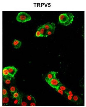 Anti-TRPV5 antibody produced in rabbit affinity isolated antibody