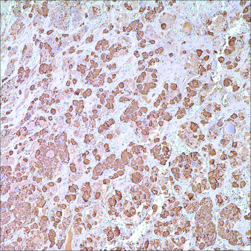 GH Rabbit Polyclonal Antibody