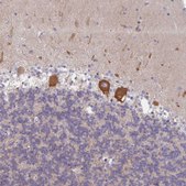 Anti-AMPD2 antibody produced in rabbit Prestige Antibodies® Powered by Atlas Antibodies, affinity isolated antibody, buffered aqueous glycerol solution