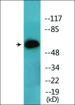 Anti-phospho-Lck (pTyr393) antibody produced in rabbit affinity isolated antibody