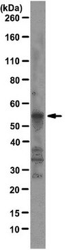 Anti-Fox1 Antibody, clone D8F8 clone D8F8, from mouse