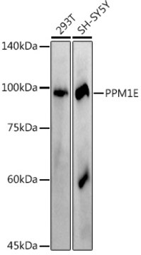 Anti-PPM1E Antibody, clone 2L7W0, Rabbit Monoclonal