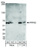 Rabbit anti-PPP5C Antibody, Affinity Purified Powered by Bethyl Laboratories, Inc.