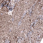 Anti-FOXL2 antibody produced in mouse Prestige Antibodies® Powered by Atlas Antibodies, clone CL12762, purified by using Protein A, buffered aqueous glycerol solution