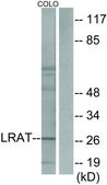 Anti-LRAT antibody produced in rabbit affinity isolated antibody